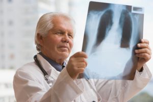chilean-doctor-looking-at-x-ray-gettyimages